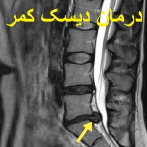 Lumbar-disc-doctor-rezaei-physiotherapy-seyed-khandan