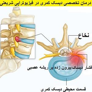 lumbar-disc-treatment-center-shariati-physiotherapy-dr.-rezaei