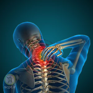 درد گردن+درمان گرفتگی عضلانی با نیدلینگ توسط متخصص