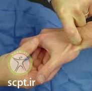 تشخیص و درمان+شکستگی استخوان اسکافوئید مچ دست+احتمال سیاه شدن یا نکروز یا جوش نخوردن