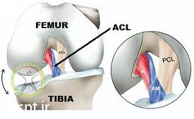 http://scpt.ir/uploads/anteromedial-and-posterolateral-acl-knee-1.jpg