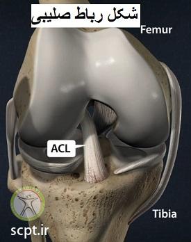 http://scpt.ir/uploads/cruciate-ligament-of-the-knee-3.jpg