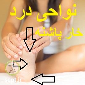 http://scpt.ir/uploads/heel-spur-physiotherapy-shariati-dr-rezaei-pain.jpg