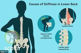 http://scpt.ir/uploads/low back pain stiffness causes.jpg
