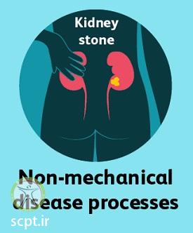 http://scpt.ir/uploads/low-back-pain-causes-kidney-stone.jpg