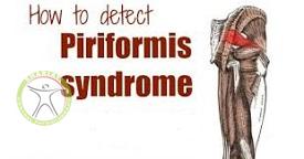 http://scpt.ir/uploads/piriformis-syndrome-diagnosis.jpg