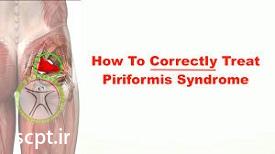 http://scpt.ir/uploads/piriformis-syndrome-treatment.jpg