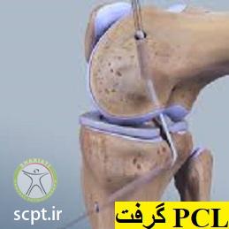 http://scpt.ir/uploads/posterior-cruciate-ligament-tear-graft.jpg