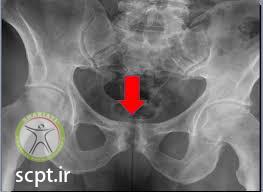 http://scpt.ir/uploads/pubic pain x ray.jpg