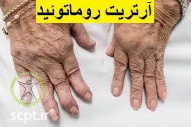 http://scpt.ir/uploads/rheumatoid-arthritis.jpg