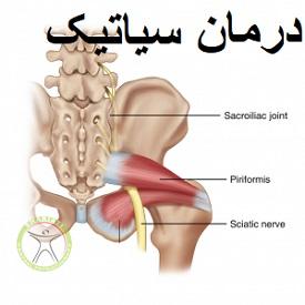 http://scpt.ir/uploads/sciatic-pain-physiotherapy-treatment-Dr-Rezaei.jpg