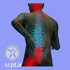 http://scpt.ir/uploads/spinal pain.jpg
