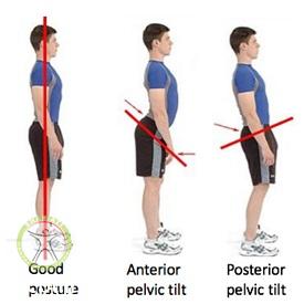 http://scpt.ir/uploads/spine-posture-diagnosis-1.jpg