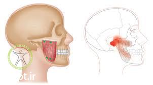 http://scpt.ir/uploads/temporomandibular joint disorder masseter.jpg