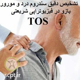 http://scpt.ir/uploads/thoracic-outlet-syndrome-diagnosis.jpg