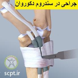 http://scpt.ir/uploads/wrist-pain-de-duervains-syndrome-2.jpg