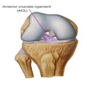 ACL-reconstruction