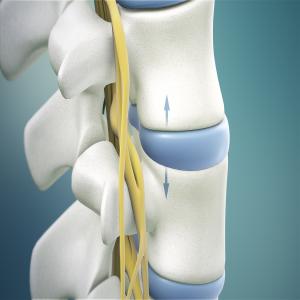 Spinaltraction