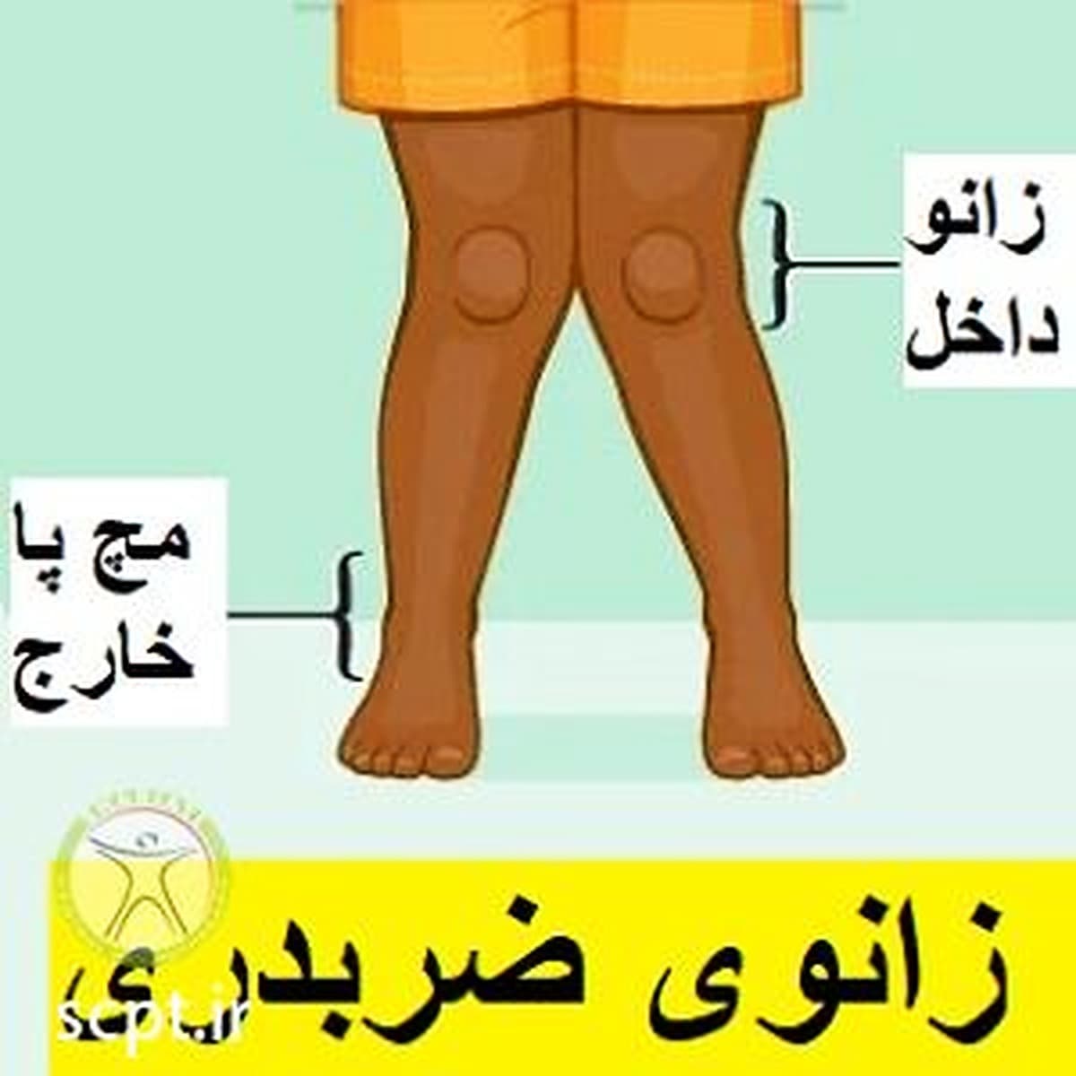 حرکات اصلاحی زانوی ضربدری