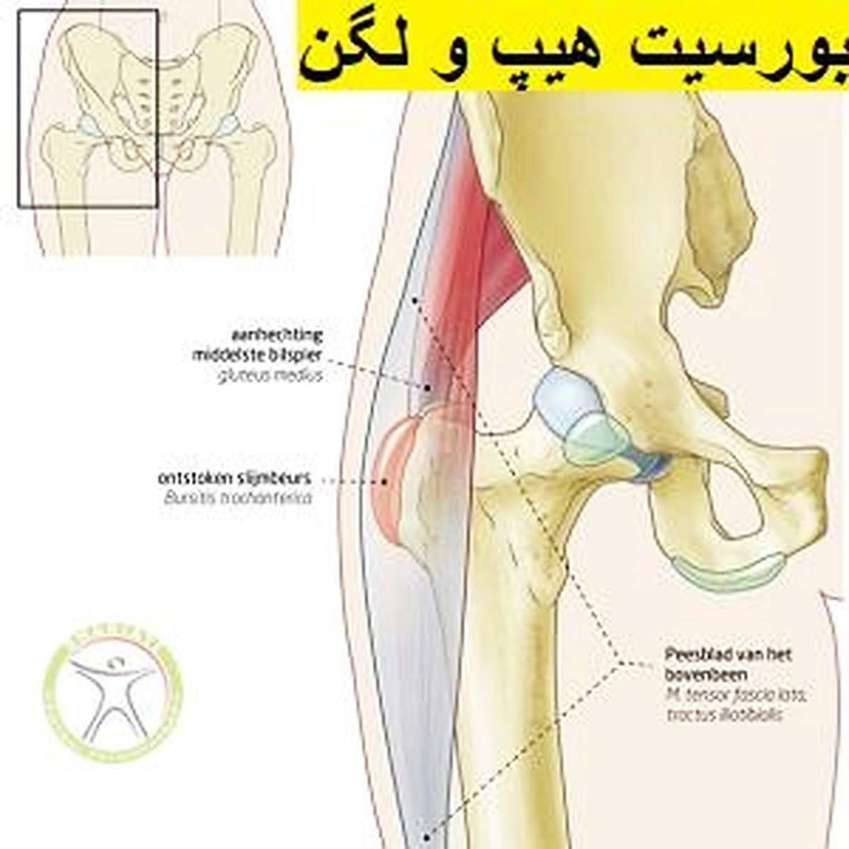 بورسیت هیپ و لگن