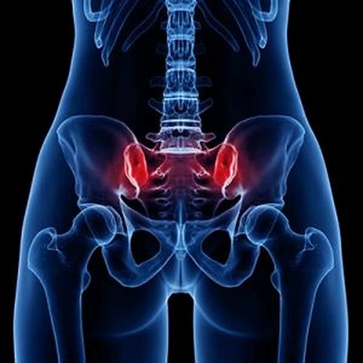 بهترین فیزیوتراپی در درد ساکروایلیاک و لگن