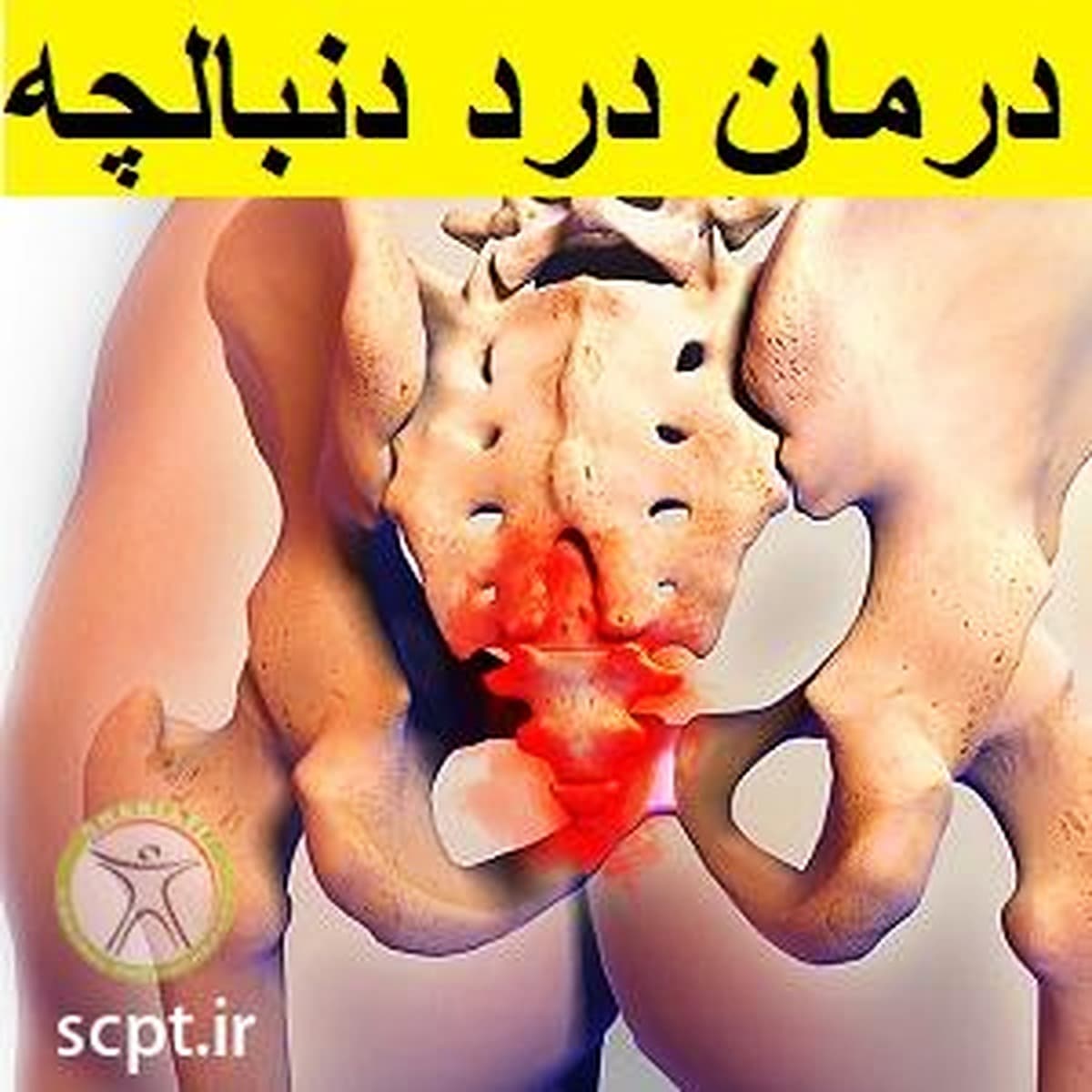 درمان درد دنبالچه در فیزیوتراپی تخصصی شریعتی