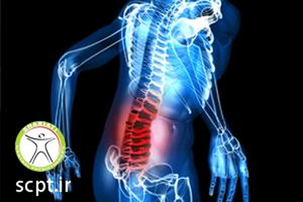 کشش ستون فقرات و جااندازی دیسکها Spinal traction
