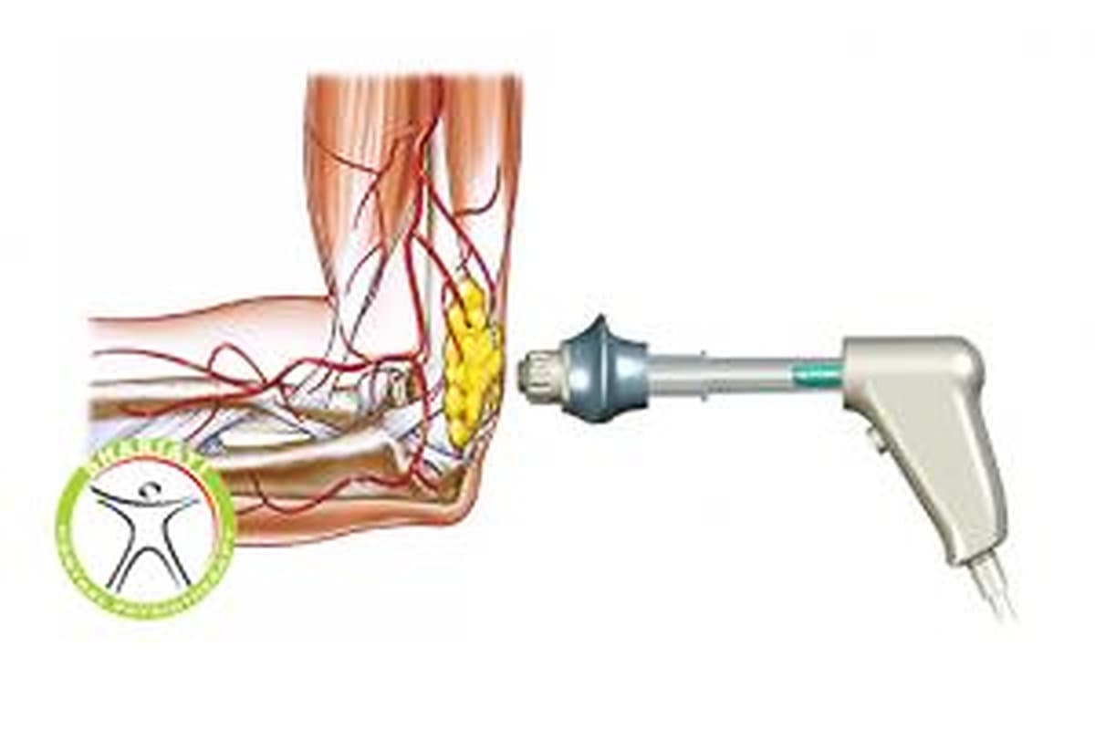 شاک ویو Shock wave