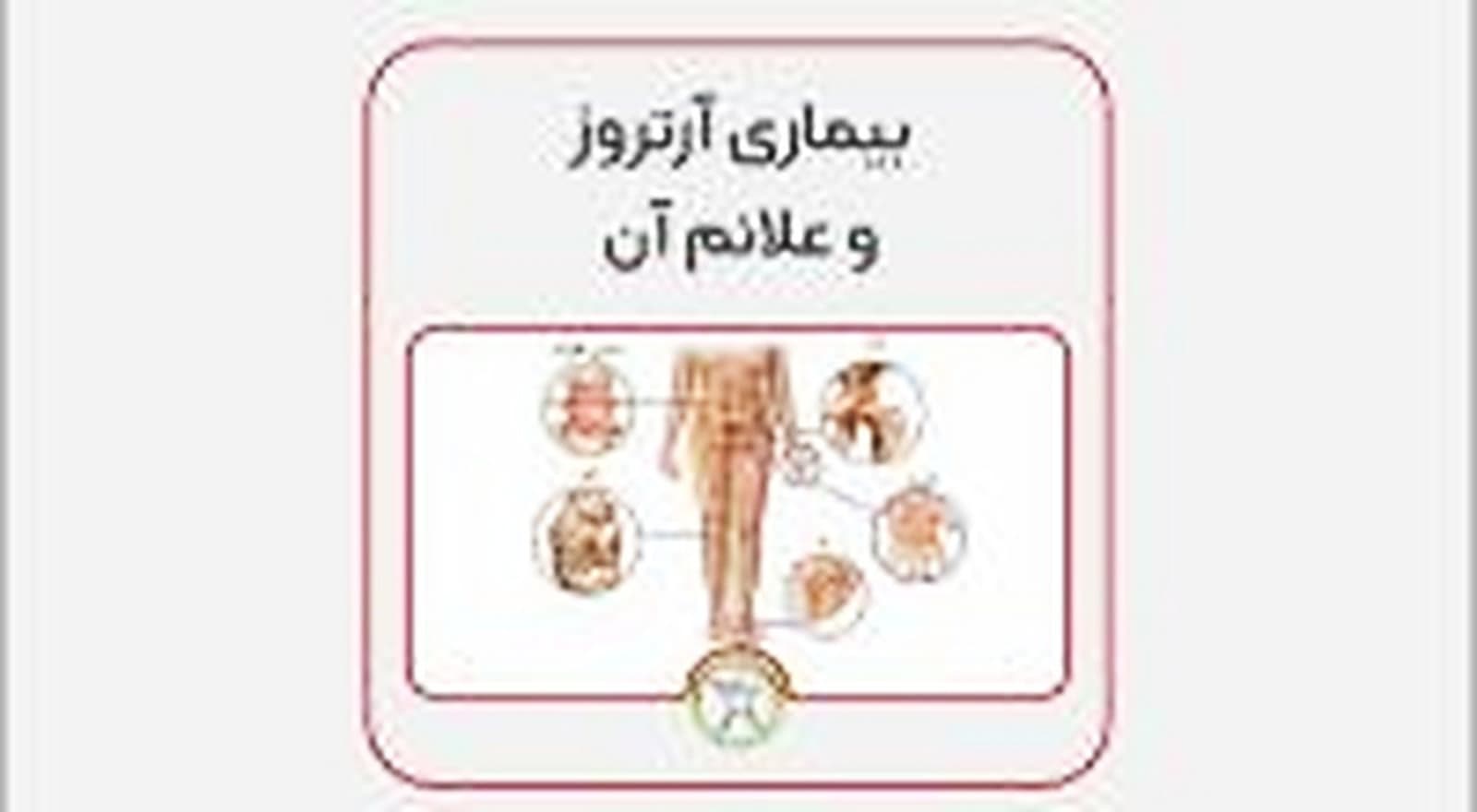 درمان آرتروز