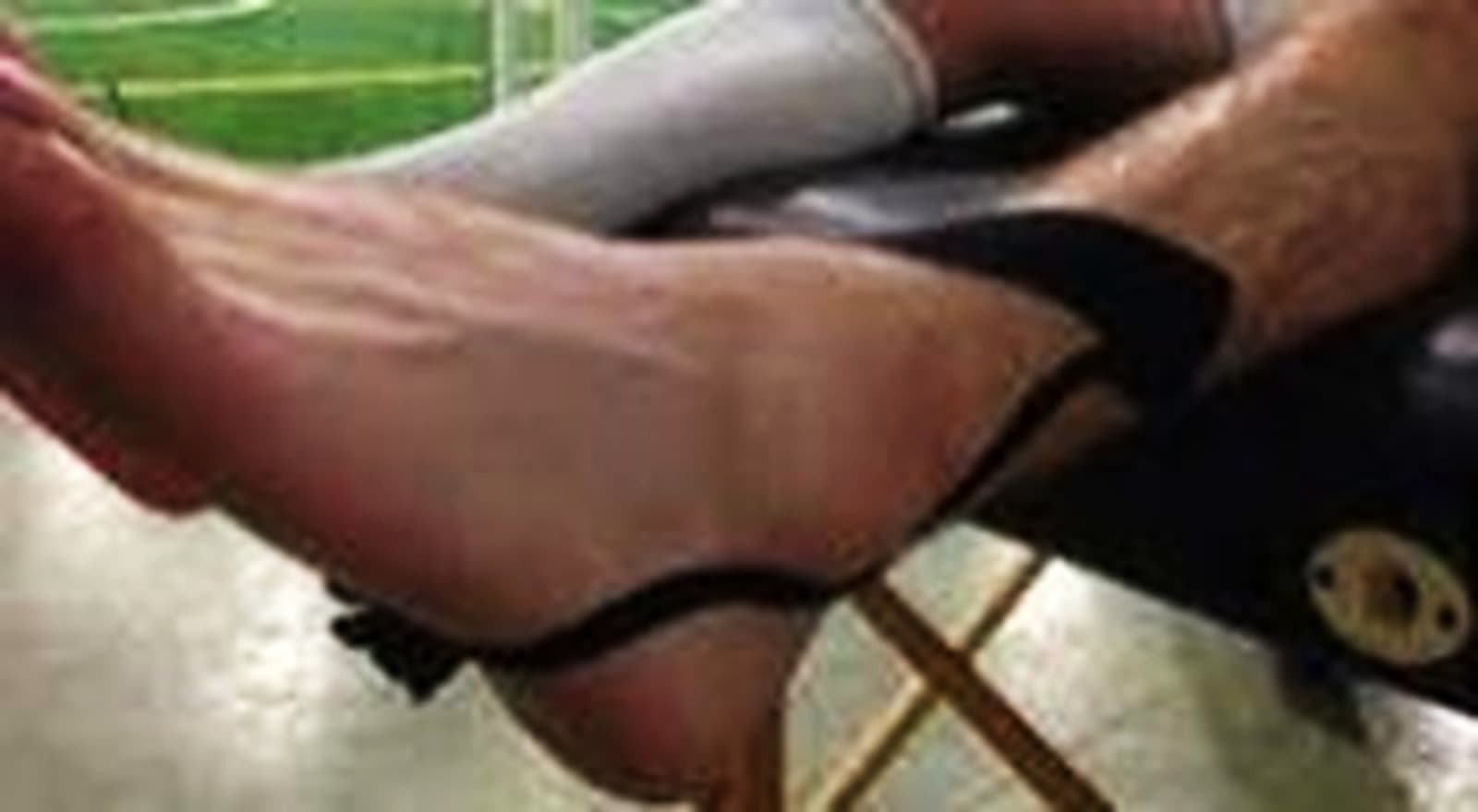 ورزش های مچ پا در پیچ خوردگی