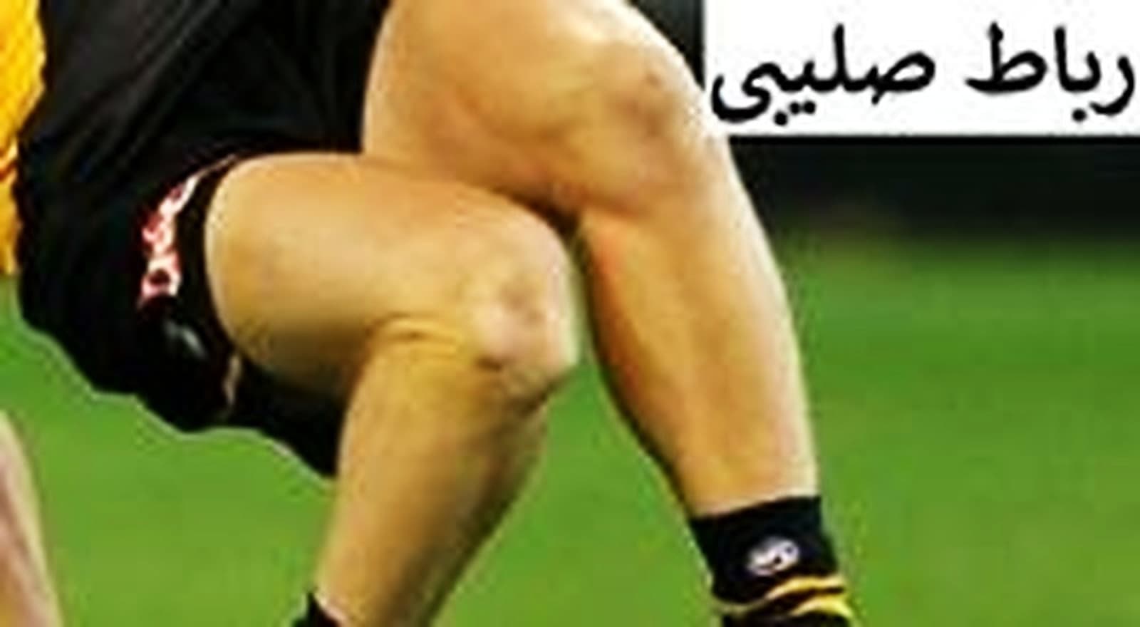 آسیب رباط صلیبی در ورزش