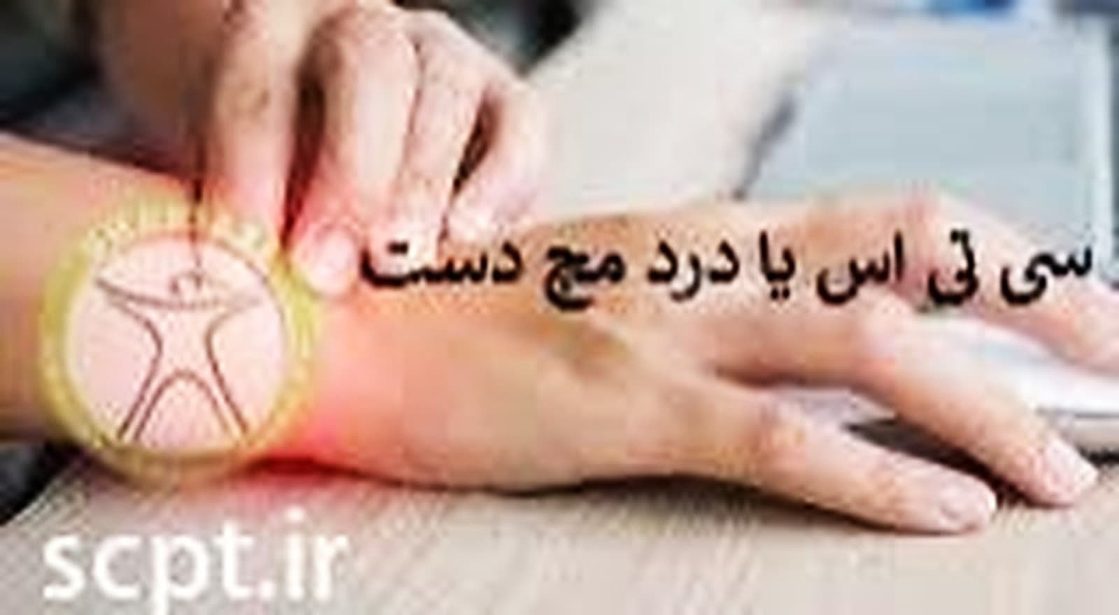 تمرین سندرم تونل کارپال سی تی اس CTS