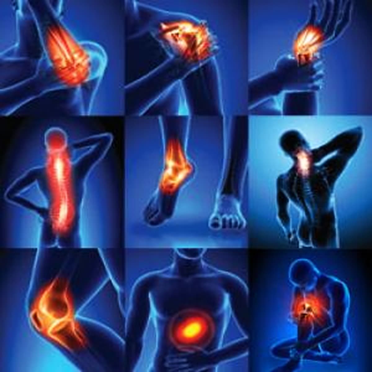 نیاز به درمان فیزیوتراپی تخصصی