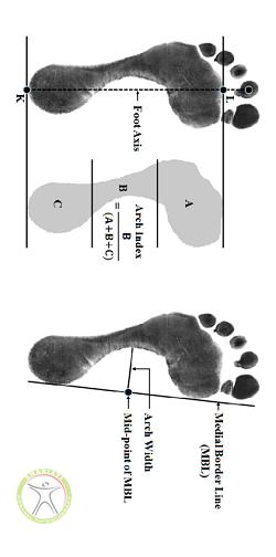 http://scpt.ir/uploads/Definitions-of-foot-arch-parameters-a-arch-index-AI-measurement-from-the-footprint.png