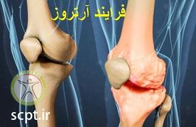 http://scpt.ir/uploads/Knee-djd-aging-physiotherapy-medicine.jpg