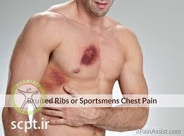 http://scpt.ir/uploads/Rib fracture injury sport.jpg