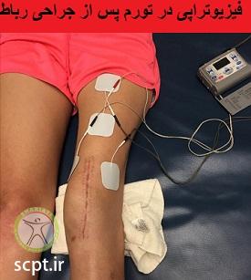 http://scpt.ir/uploads/acl-reconstruction-swelling-electrotherapy.jpg