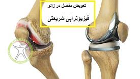 http://scpt.ir/uploads/arthrosis-knee-arthroplasty.jpg