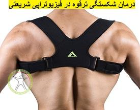 http://scpt.ir/uploads/clavicle-fracture-treatment.jpg