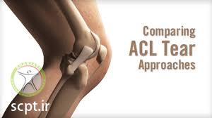 http://scpt.ir/uploads/comparing acl approaches.jpg