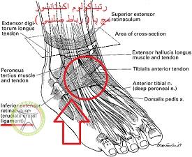 http://scpt.ir/uploads/cruciate-ligament-foot-1.jpg