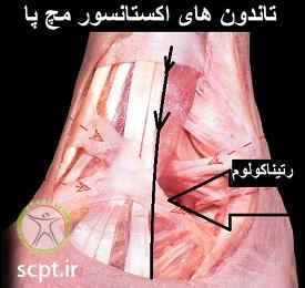 http://scpt.ir/uploads/cruciate-ligament-foot-4.jpg