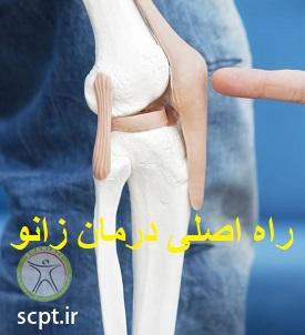 http://scpt.ir/uploads/knee-osteoarthritis-DJD-rehabilitation.jpg