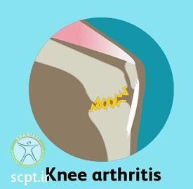 http://scpt.ir/uploads/knee-pain-types-1.jpg