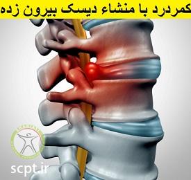 http://scpt.ir/uploads/low-back-pain-disc-herniation.jpg