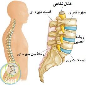 http://scpt.ir/uploads/lumbar-disc-herniation-anatomy.jpg