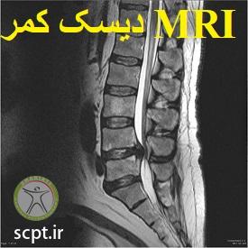 http://scpt.ir/uploads/lumbar-disc-herniation-diagnosis-MRI.jpg