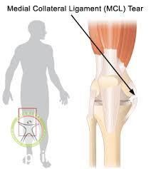 http://scpt.ir/uploads/medial collateral ligament.jpg
