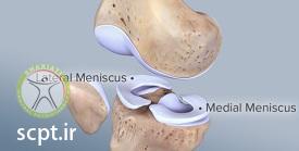 http://scpt.ir/uploads/meniscus-anatomy-1.jpg