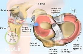 http://scpt.ir/uploads/meniscus-anatomy.jpg